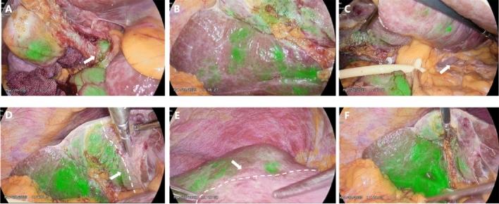 https://cdn.ncbi.nlm.nih.gov/pmc/blobs/8000/10824724/b1d3e6c51128/41598_2024_52904_Fig6_HTML.jpg