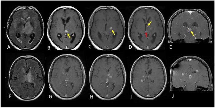 https://cdn.ncbi.nlm.nih.gov/pmc/blobs/800a/8753228/f2cd264a6a99/10.1177_15347354211068417-fig1.jpg