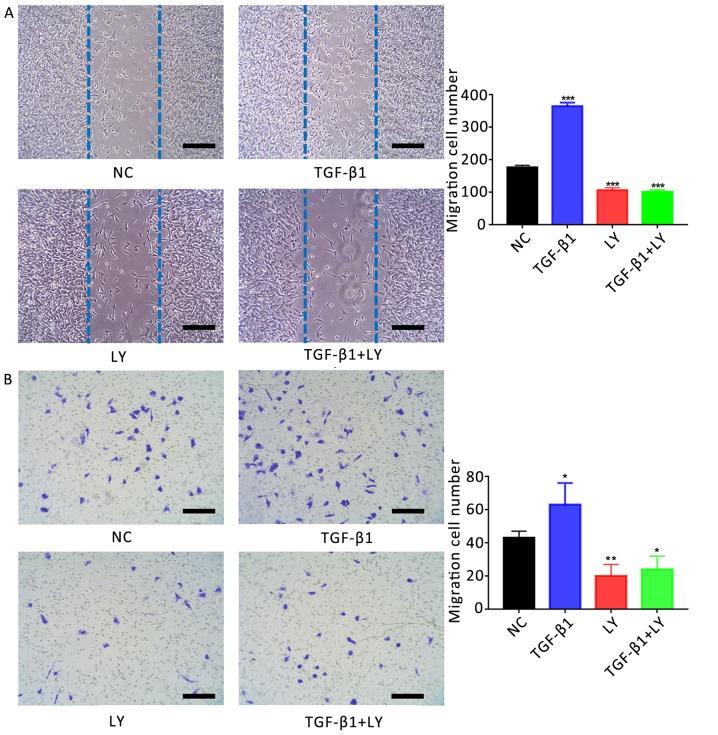 https://cdn.ncbi.nlm.nih.gov/pmc/blobs/800b/6471541/1f884aeceee5/MMR-19-05-3505-g04.jpg