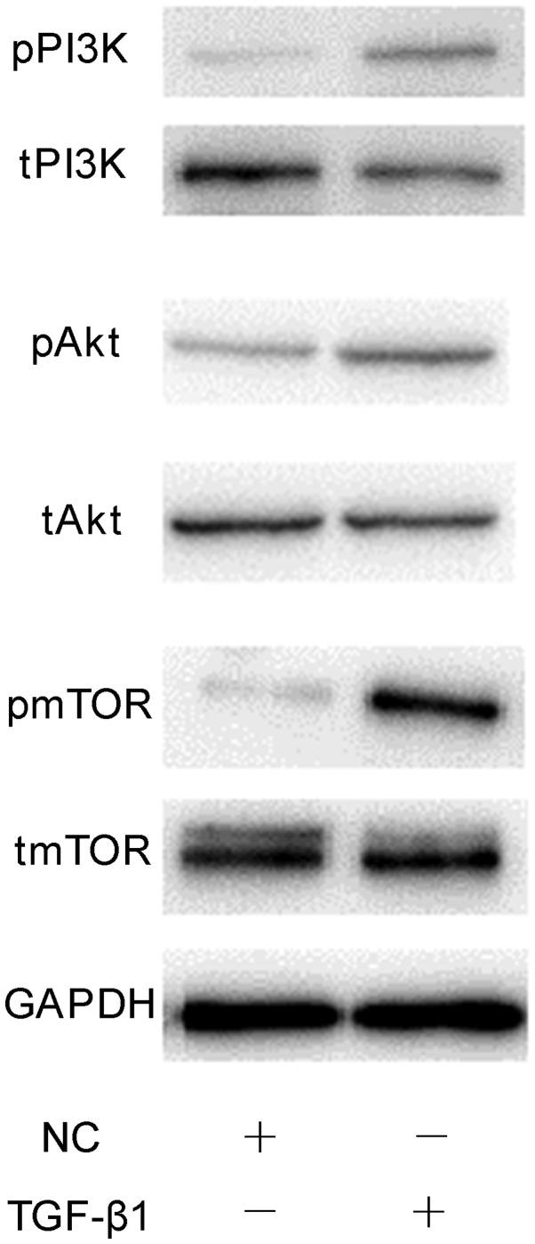 https://cdn.ncbi.nlm.nih.gov/pmc/blobs/800b/6471541/416bbe41a77e/MMR-19-05-3505-g09.jpg