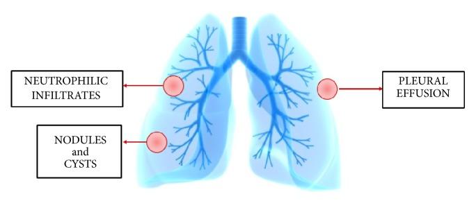 https://cdn.ncbi.nlm.nih.gov/pmc/blobs/8011/6590566/972f2c0f7e6b/BMRI2019-7315274.002.jpg