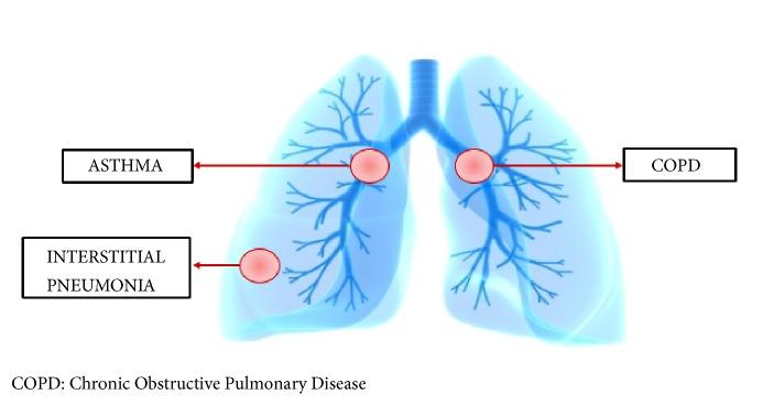 https://cdn.ncbi.nlm.nih.gov/pmc/blobs/8011/6590566/e27795a97a23/BMRI2019-7315274.001.jpg