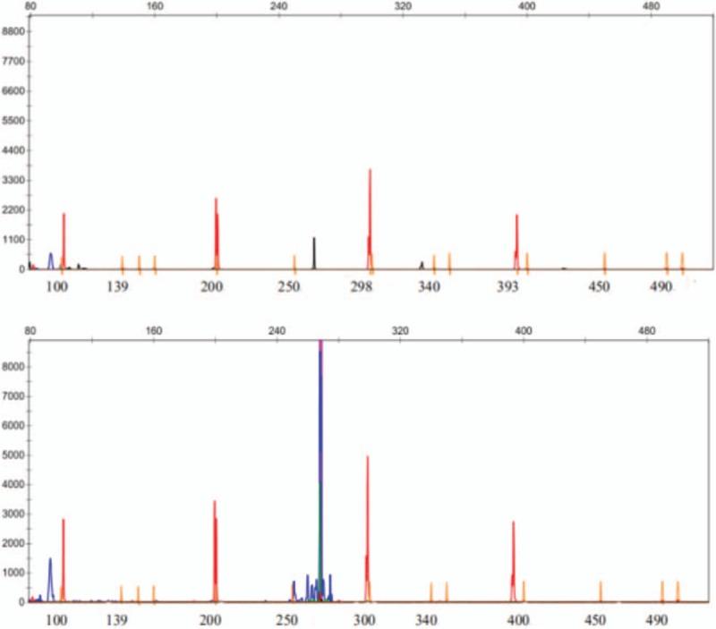 https://cdn.ncbi.nlm.nih.gov/pmc/blobs/8017/6221671/0227605be706/medi-97-e13064-g004.jpg