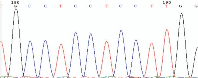 https://cdn.ncbi.nlm.nih.gov/pmc/blobs/8017/6221671/0bef9a3b7fce/medi-97-e13064-g005.jpg