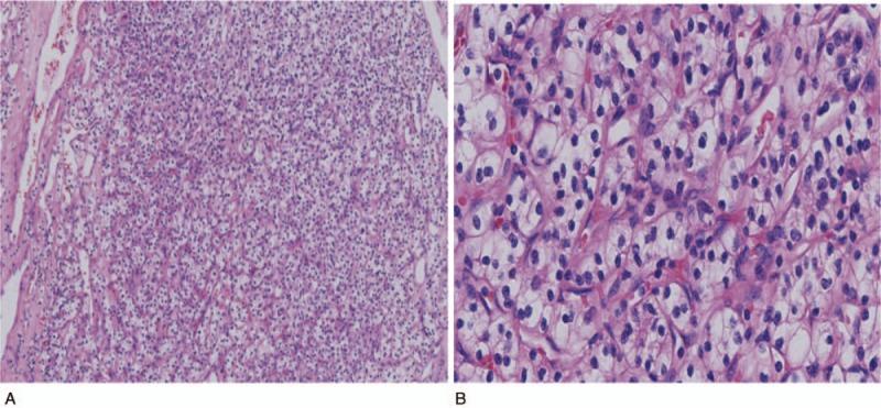https://cdn.ncbi.nlm.nih.gov/pmc/blobs/8017/6221671/ddd012116aad/medi-97-e13064-g001.jpg