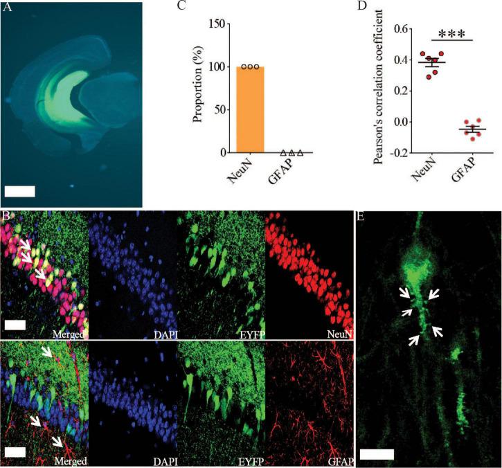 https://cdn.ncbi.nlm.nih.gov/pmc/blobs/801b/9354987/c1cc195bceab/fnagi-14-914491-g002.jpg