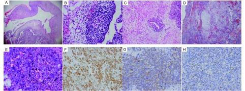 https://cdn.ncbi.nlm.nih.gov/pmc/blobs/801c/6000696/7260984f575c/zgfazz-13-5-550-1.jpg
