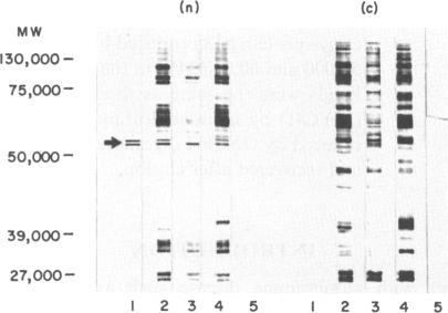 https://cdn.ncbi.nlm.nih.gov/pmc/blobs/801f/1385729/b1487cb93fd8/immunology00132-0126-b.jpg