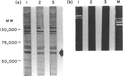 https://cdn.ncbi.nlm.nih.gov/pmc/blobs/801f/1385729/f31ff9473d7d/immunology00132-0127-a.jpg