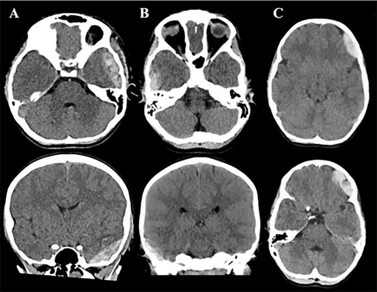 https://cdn.ncbi.nlm.nih.gov/pmc/blobs/801f/8203002/040851f8f5a5/wjem-22-782-g003.jpg
