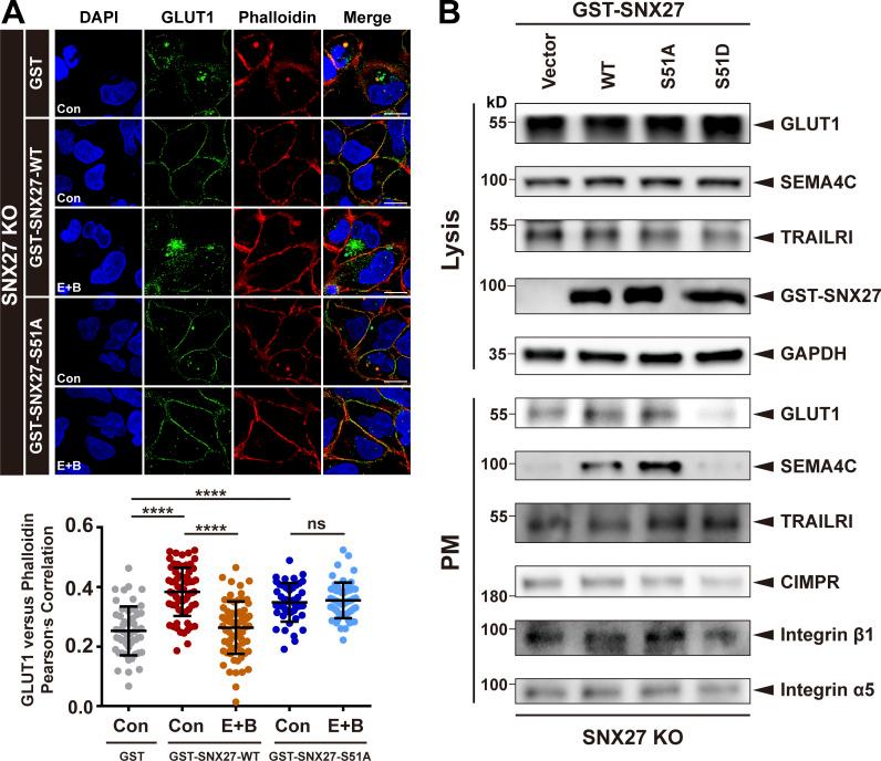 https://cdn.ncbi.nlm.nih.gov/pmc/blobs/8021/7901142/70b6c9f03765/JCB_202010048_Fig6.jpg