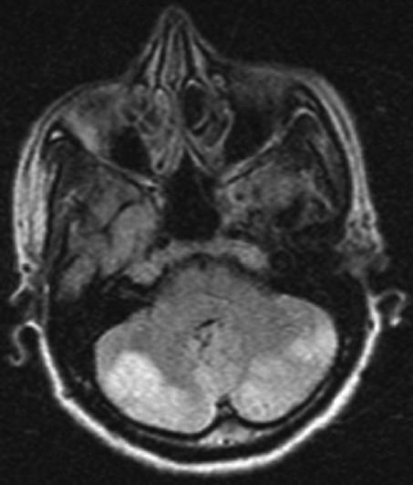 https://cdn.ncbi.nlm.nih.gov/pmc/blobs/8022/3271473/5cbe6f801c37/AIAN-14-301-g001.jpg
