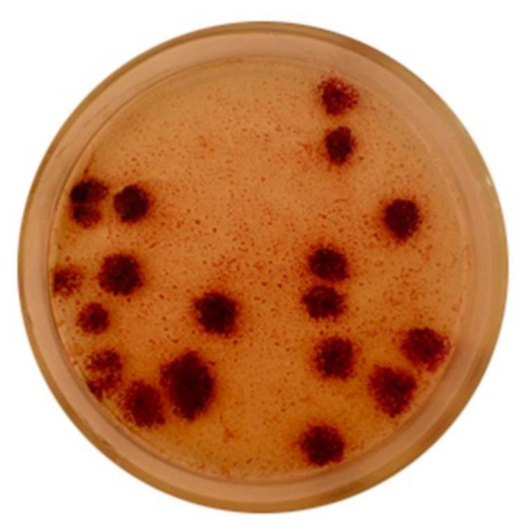 https://cdn.ncbi.nlm.nih.gov/pmc/blobs/8024/8232776/47dd450150a7/ijms-22-06398-g001.jpg