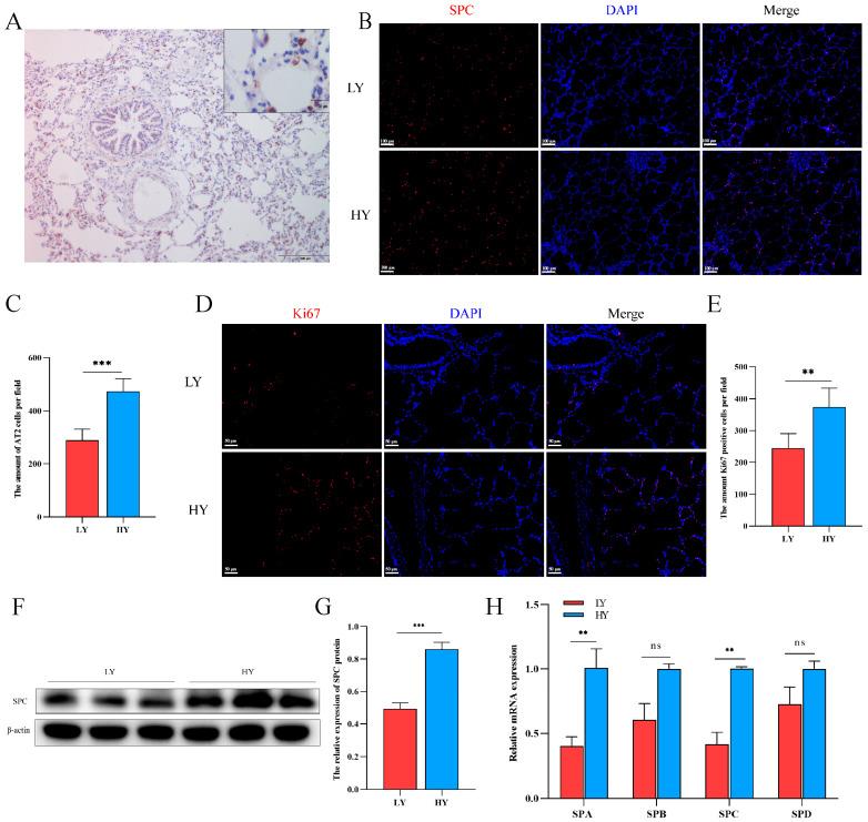 https://cdn.ncbi.nlm.nih.gov/pmc/blobs/802c/10855765/4e17863e7684/ijms-25-01442-g002.jpg