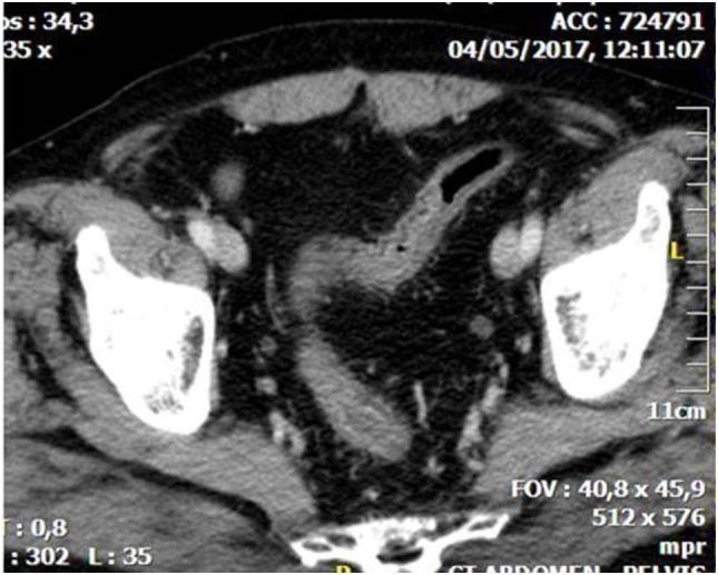 https://cdn.ncbi.nlm.nih.gov/pmc/blobs/8033/5591371/901e46eca0f3/fsurg-04-00047-g001.jpg