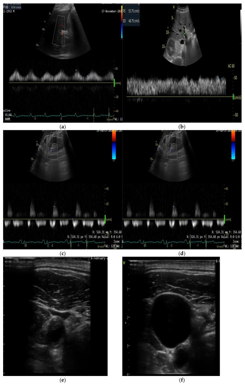 https://cdn.ncbi.nlm.nih.gov/pmc/blobs/8039/12071992/d66817315f16/diagnostics-15-01083-g001.jpg