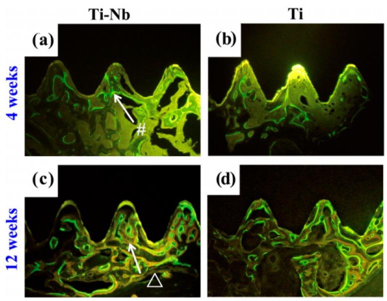 https://cdn.ncbi.nlm.nih.gov/pmc/blobs/8039/6164106/d58ed95a96c5/materials-11-01716-g033.jpg