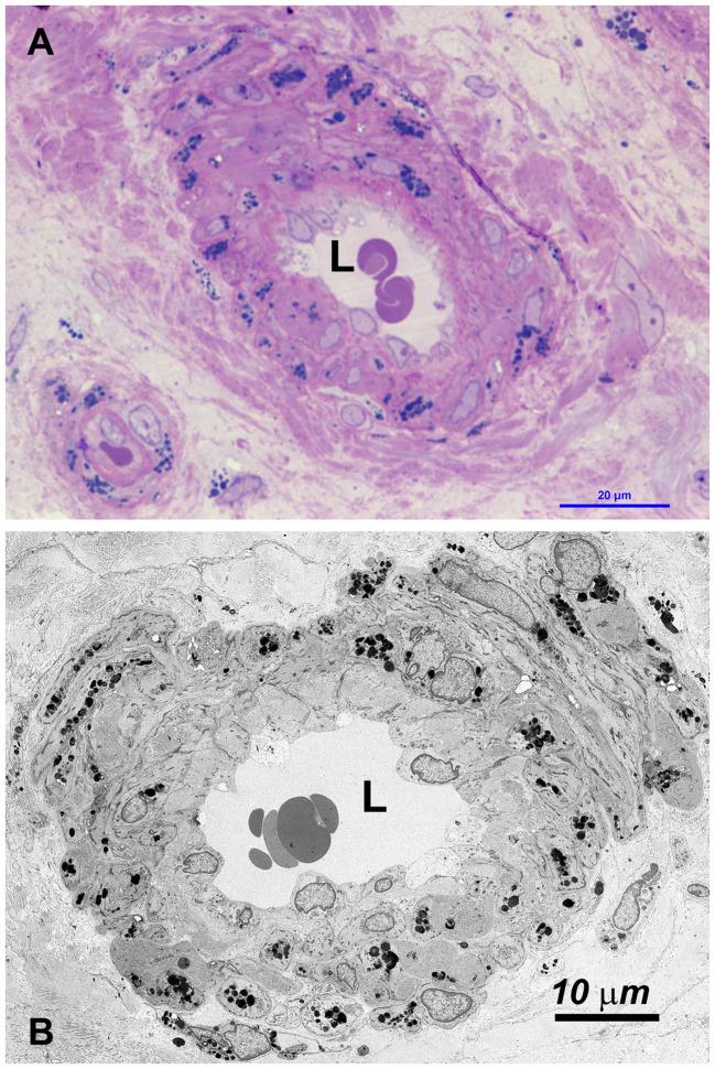 https://cdn.ncbi.nlm.nih.gov/pmc/blobs/8046/10917934/4281bdaade23/fendo-15-1340188-g004.jpg