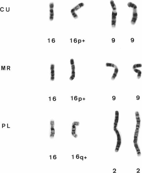 https://cdn.ncbi.nlm.nih.gov/pmc/blobs/8052/1682036/232bc618af71/ajhg00063-0148-a.jpg