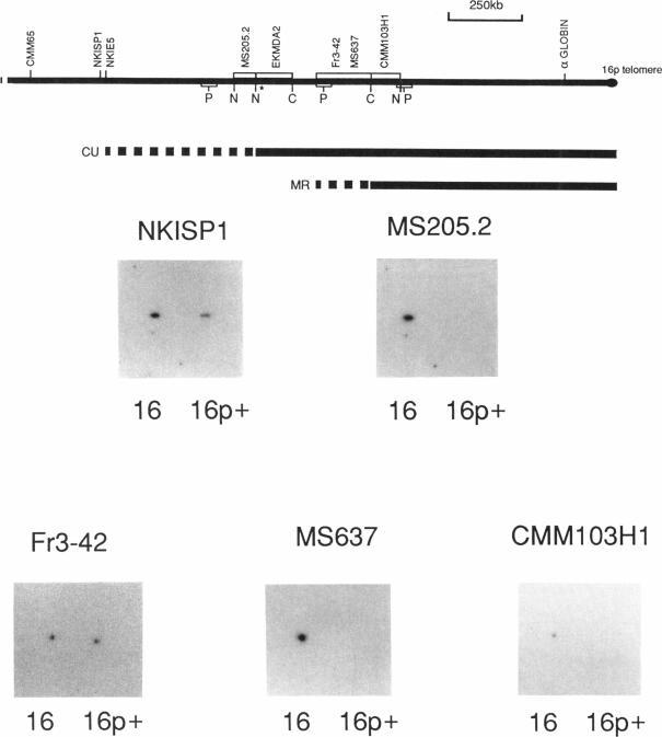 https://cdn.ncbi.nlm.nih.gov/pmc/blobs/8052/1682036/9e52e810a83d/ajhg00063-0146-a.jpg