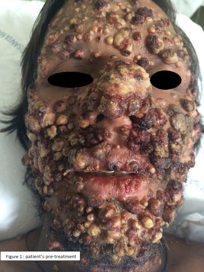 https://cdn.ncbi.nlm.nih.gov/pmc/blobs/8052/9425681/7f121b0d5c54/pl1.jpg