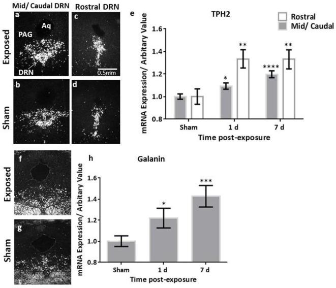 https://cdn.ncbi.nlm.nih.gov/pmc/blobs/8055/7593658/6d5ebb8f666e/fneur-11-540144-g0003.jpg