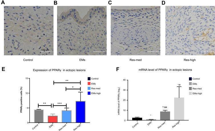 https://cdn.ncbi.nlm.nih.gov/pmc/blobs/805d/8487867/ecf8b20fcbfa/DDDT-15-4141-g0006.jpg