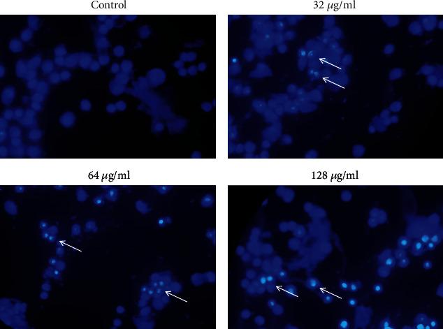 https://cdn.ncbi.nlm.nih.gov/pmc/blobs/805f/10896653/7a9466e536f3/BMRI2024-7145339.005.jpg