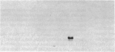 https://cdn.ncbi.nlm.nih.gov/pmc/blobs/8060/294905/f7121557f2b5/jcinvest00029-0191-a.jpg