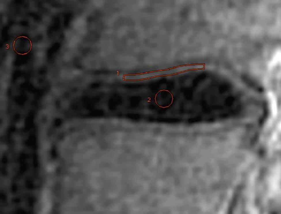 https://cdn.ncbi.nlm.nih.gov/pmc/blobs/8067/10120173/3dbdf6bc16ff/12880_2023_1014_Fig2_HTML.jpg