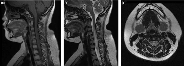 https://cdn.ncbi.nlm.nih.gov/pmc/blobs/8079/6749488/d87707922b89/BRB3-9-e01374-g002.jpg