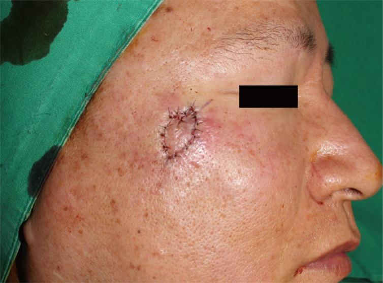 https://cdn.ncbi.nlm.nih.gov/pmc/blobs/8085/5556805/6052da991eee/acfs-17-158-g004.jpg