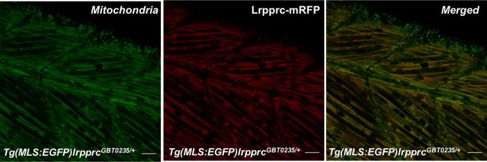 https://cdn.ncbi.nlm.nih.gov/pmc/blobs/8088/9859037/32ff7119f571/elife-65488-fig3-figsupp1.jpg