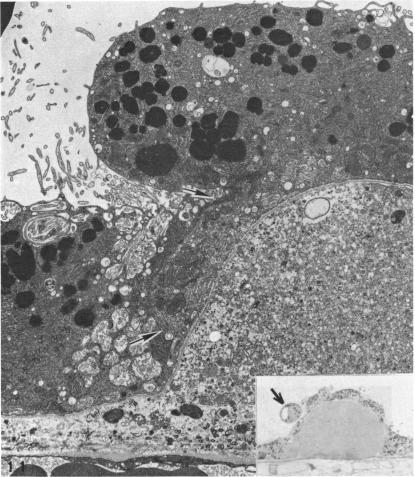 https://cdn.ncbi.nlm.nih.gov/pmc/blobs/808e/1312140/d522e3d92ec5/taos00021-0245-a.jpg