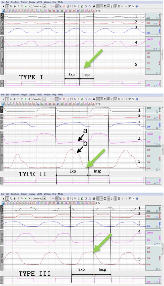 https://cdn.ncbi.nlm.nih.gov/pmc/blobs/809d/11330465/af16522c19db/41598_2024_63609_Fig2_HTML.jpg