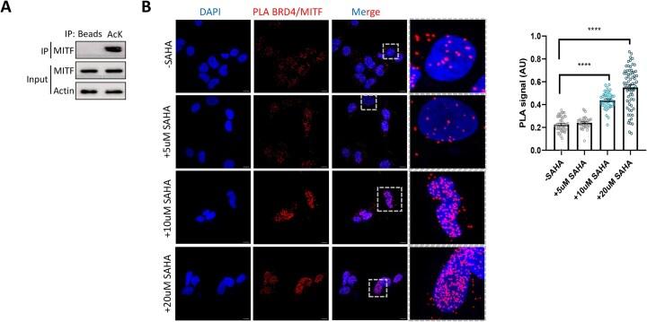 https://cdn.ncbi.nlm.nih.gov/pmc/blobs/80a6/12342177/e7e3fa76a467/zcaf023fig6.jpg