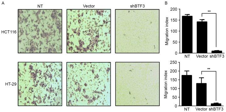 https://cdn.ncbi.nlm.nih.gov/pmc/blobs/80a6/6313191/5f1d2c209c53/ol-17-01-0113-g03.jpg
