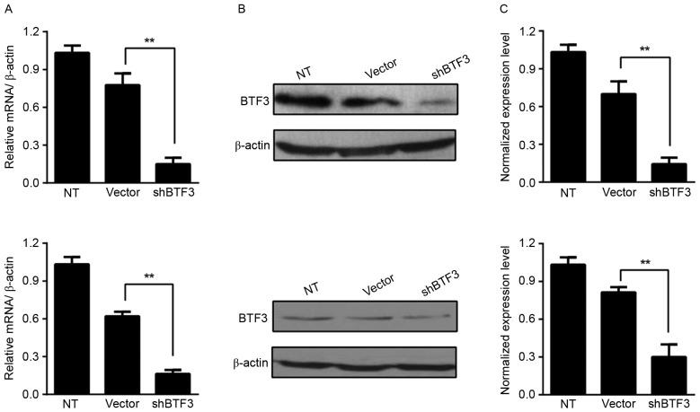 https://cdn.ncbi.nlm.nih.gov/pmc/blobs/80a6/6313191/a4c3480c2ed6/ol-17-01-0113-g00.jpg