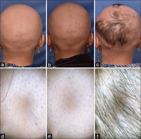 https://cdn.ncbi.nlm.nih.gov/pmc/blobs/80ad/7659740/c147e444cb2a/IJT-12-107-g004.jpg