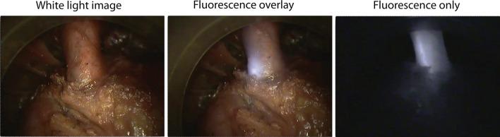 https://cdn.ncbi.nlm.nih.gov/pmc/blobs/80af/5846816/d61cc323c4a5/10151_2018_1757_Fig3_HTML.jpg