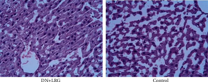 https://cdn.ncbi.nlm.nih.gov/pmc/blobs/80b5/8046563/9c15150d0641/JDR2021-8873956.017.jpg