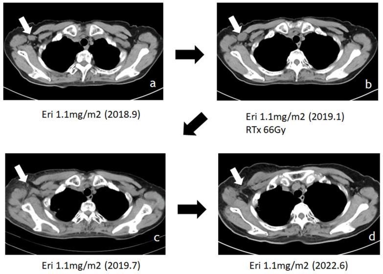 https://cdn.ncbi.nlm.nih.gov/pmc/blobs/80b6/10905407/e4b9842a8d1a/jcav15p1786g007.jpg