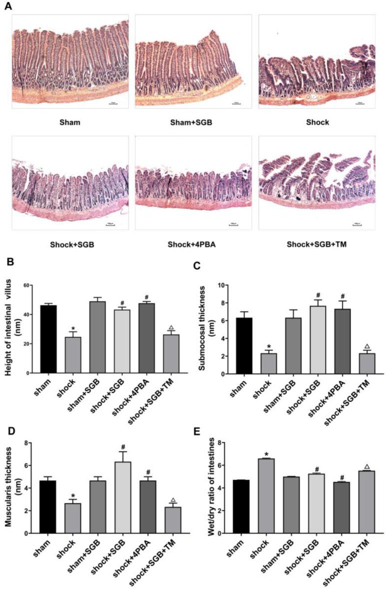 https://cdn.ncbi.nlm.nih.gov/pmc/blobs/80b6/7484657/950fa8202633/ijmsv17p2147g002.jpg