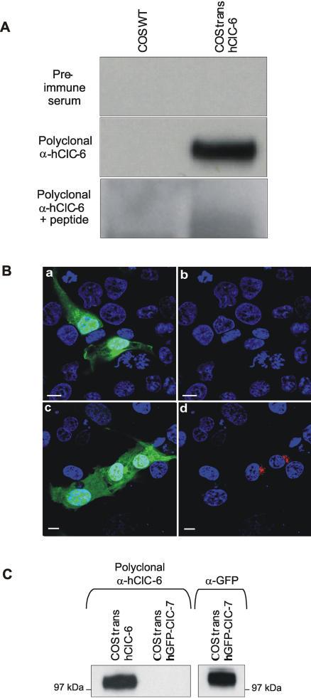 https://cdn.ncbi.nlm.nih.gov/pmc/blobs/80b7/1868598/3460b441ac44/pone.0000474.g002.jpg