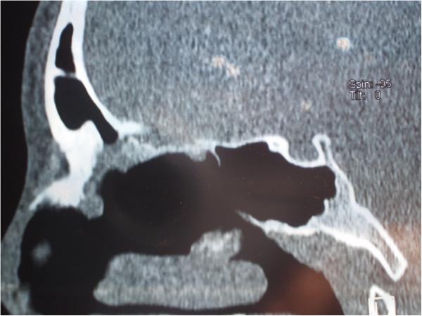 https://cdn.ncbi.nlm.nih.gov/pmc/blobs/80b7/4096441/22956a1e0642/1752-1947-8-161-6.jpg