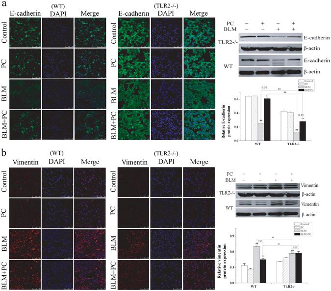 https://cdn.ncbi.nlm.nih.gov/pmc/blobs/80b8/5517415/3c19c00a4594/41598_2017_6021_Fig4_HTML.jpg