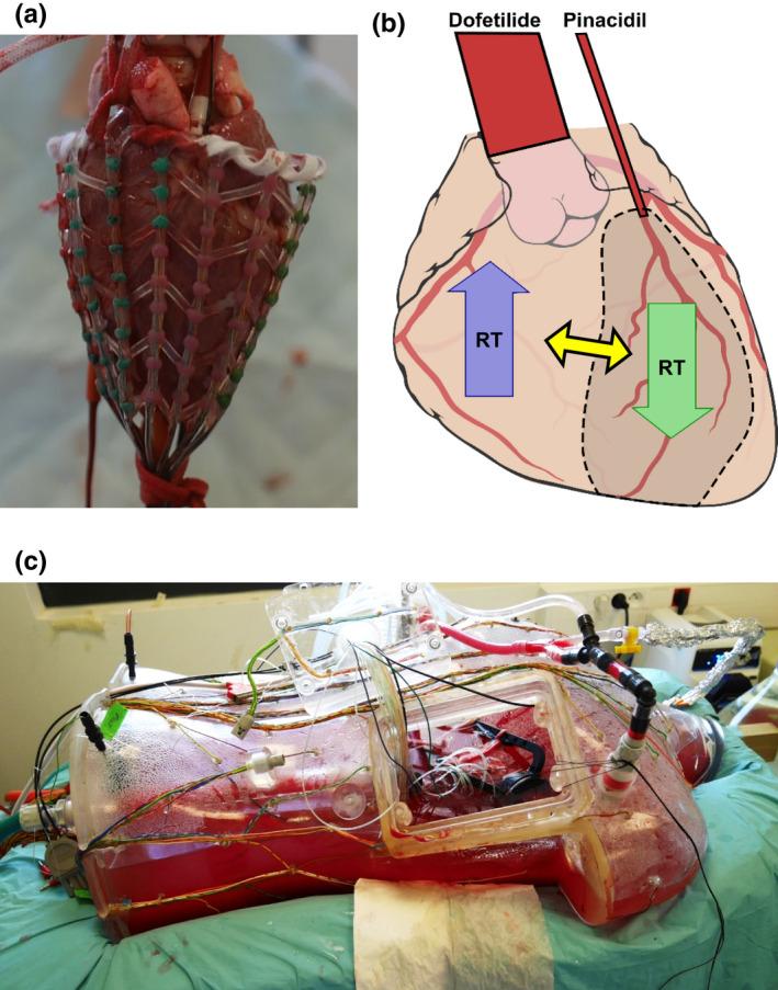 https://cdn.ncbi.nlm.nih.gov/pmc/blobs/80c0/9674780/4c1ad7af8219/ANEC-27-e12994-g005.jpg