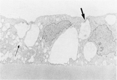 https://cdn.ncbi.nlm.nih.gov/pmc/blobs/80c2/1298599/a76a117465e1/taos00011-0519-a.jpg