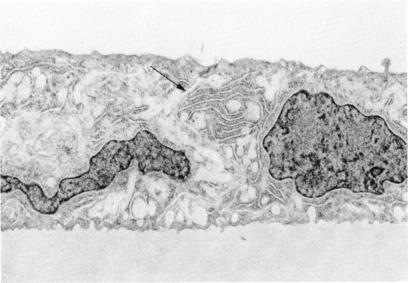 https://cdn.ncbi.nlm.nih.gov/pmc/blobs/80c2/1298599/ae78c16c93f5/taos00011-0520-a.jpg