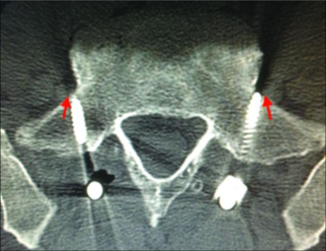 https://cdn.ncbi.nlm.nih.gov/pmc/blobs/80c3/7110297/9e49183a9e10/SNI-11-42-g004.jpg